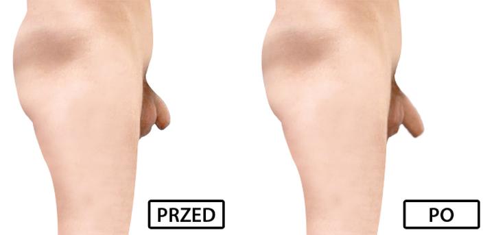 Ćwiczenia na zwiększenie rozmiaru