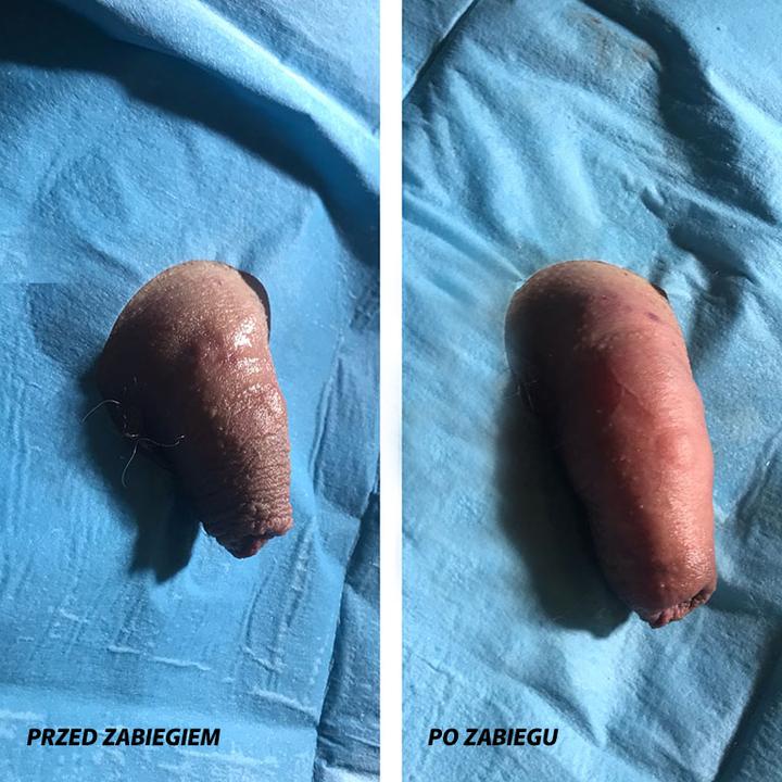 Skuteczne metody na to, jak zwiększyć rozmiar członka w bezpieczny sposób