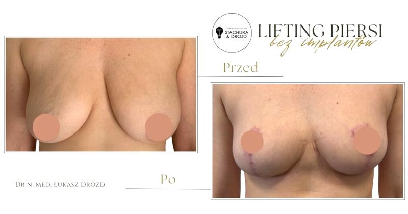 Preferencje mężczyzn